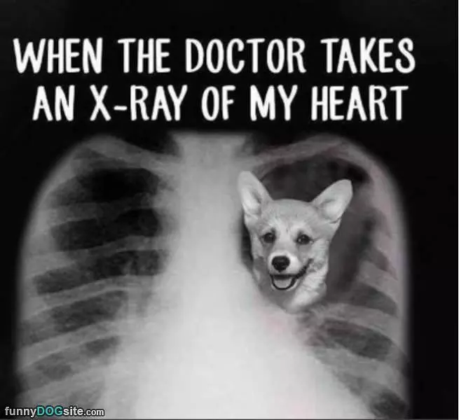 Xray Of My Heart