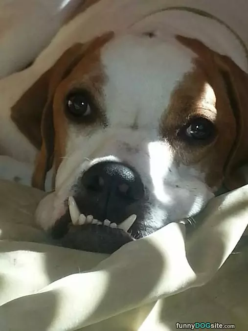 My Underbite